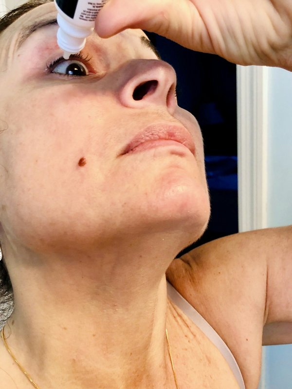 Sécheresse oculaire traitement : solutions efficaces pour votre confort